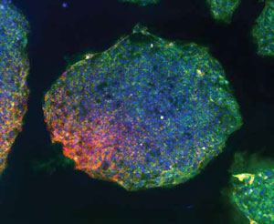 iPSCs